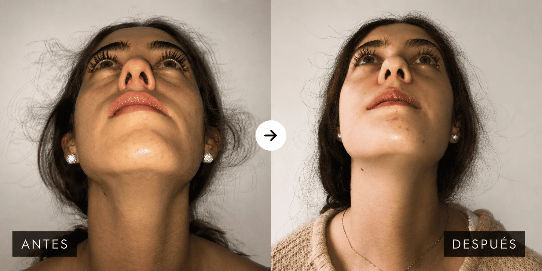 Traumatología facial